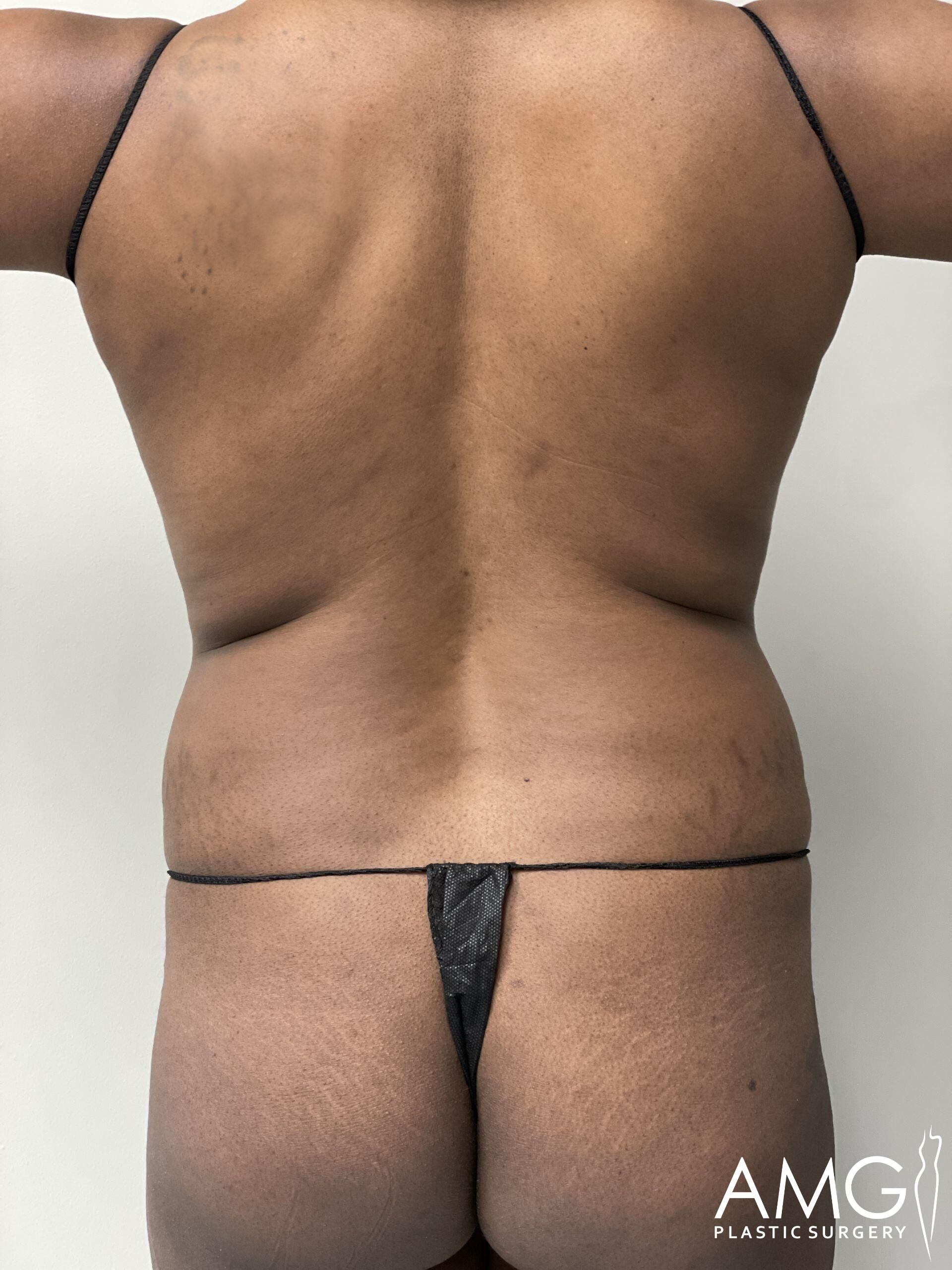 Person in minimal clothing shown from the back against a plain background, displaying their back and posture.