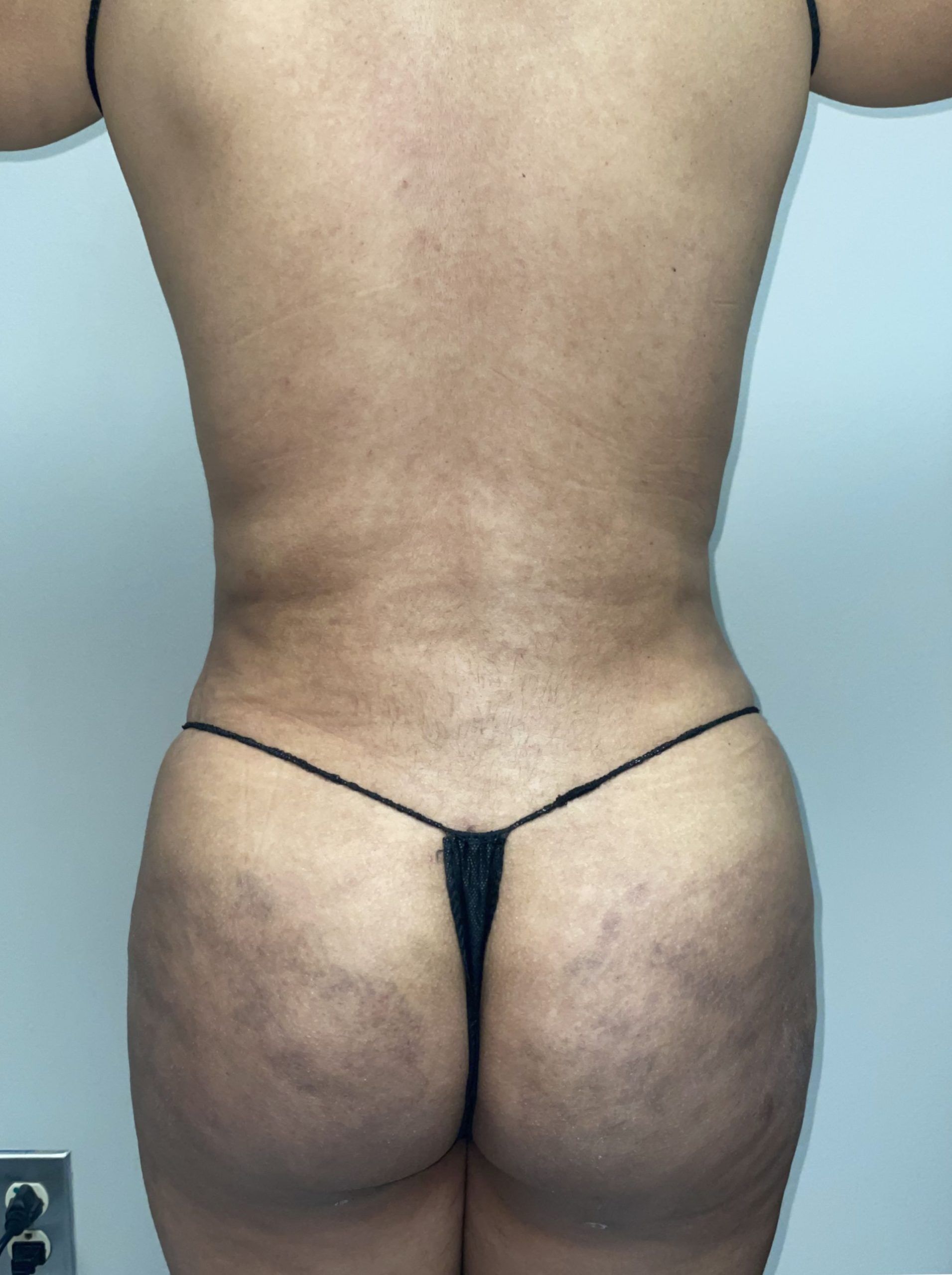 A person's back view, wearing minimal black underwear, with a visible tan line and some skin texture.