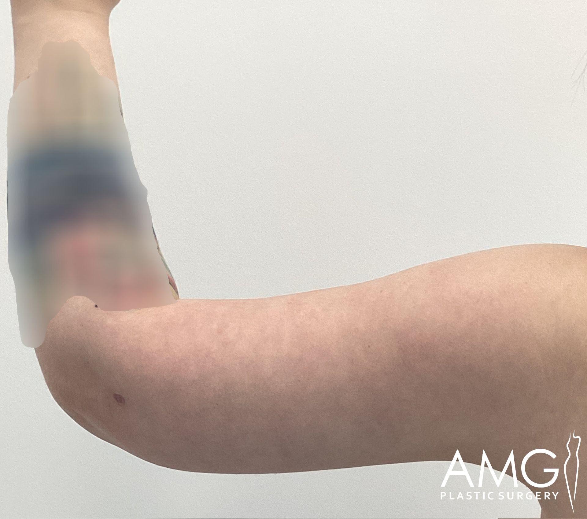 A person's arm is shown in profile against a plain background with 