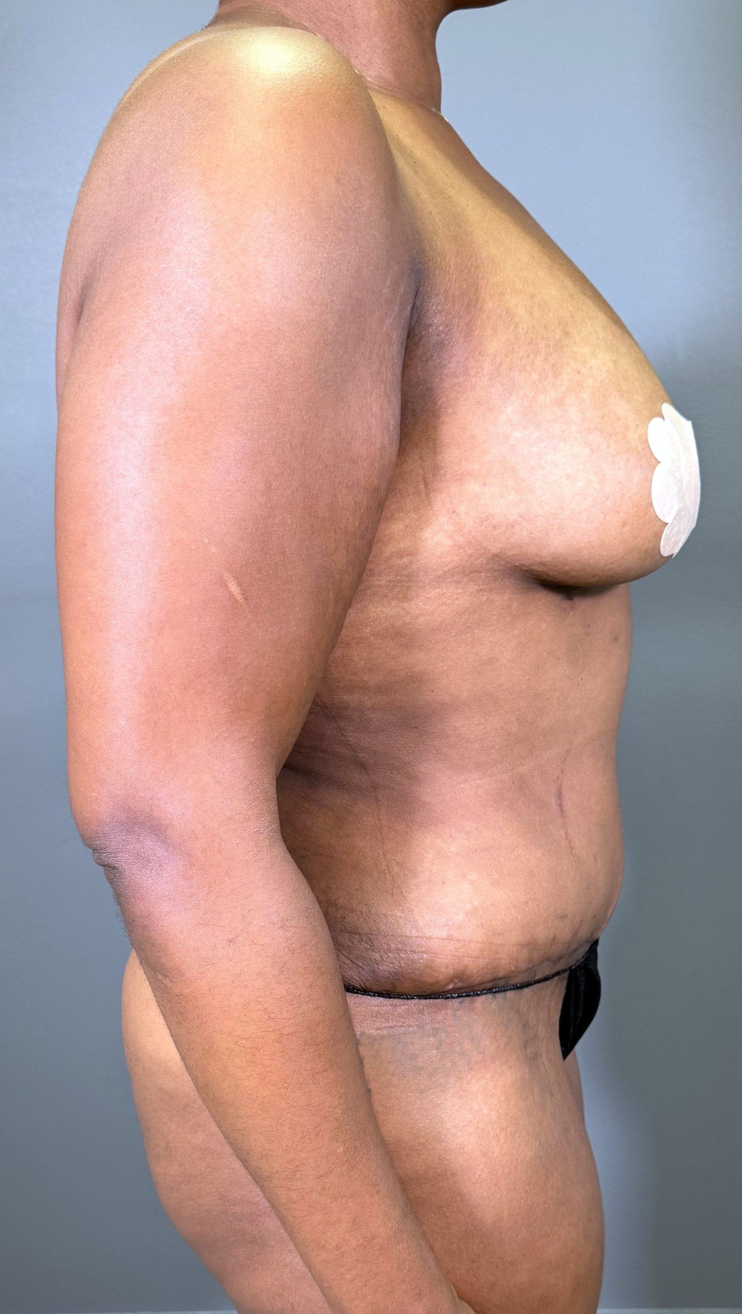 A person stands sideways, showing their upper body. Their arm is resting by their side, and there is a small bandage on one side of the chest. Logo in the bottom right corner.