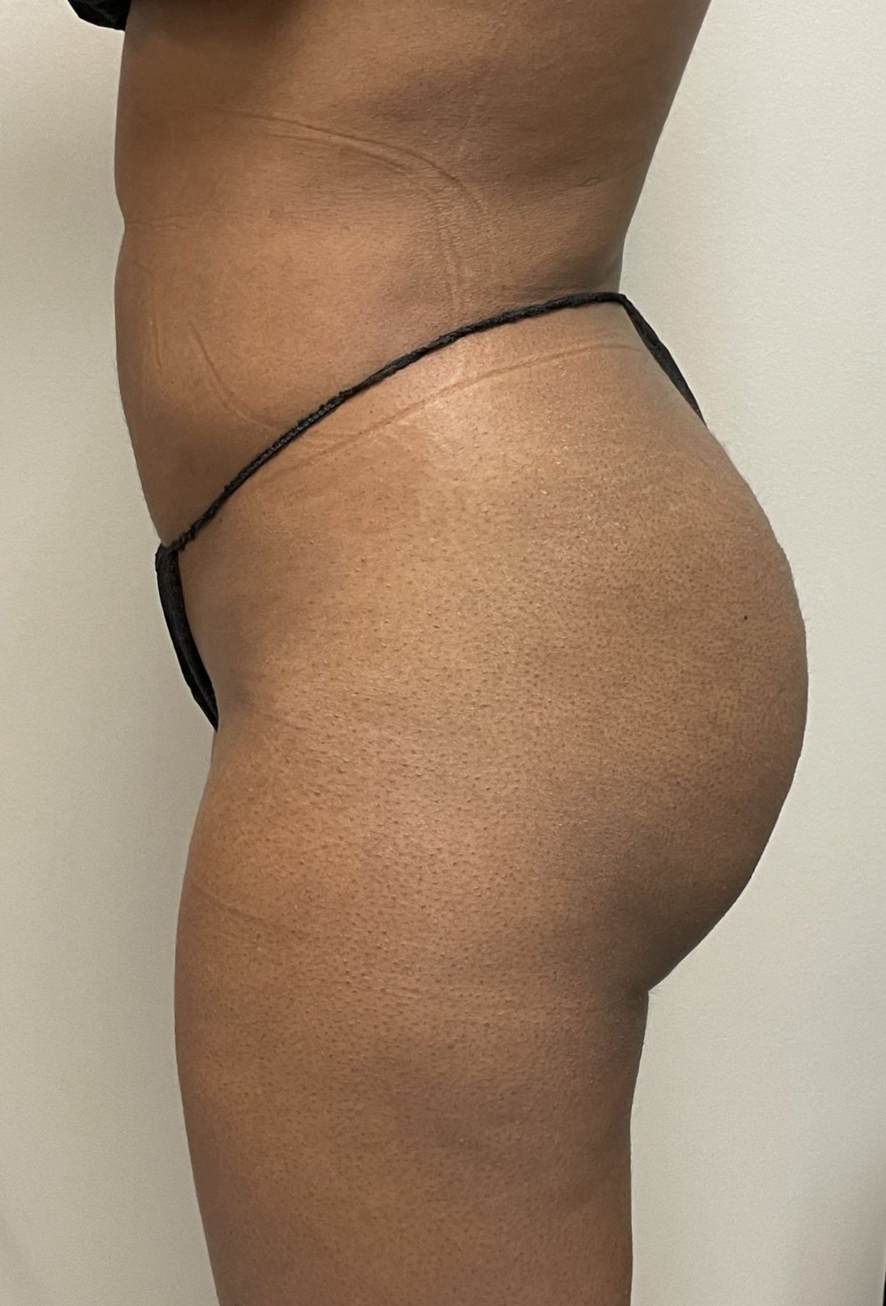 A person in minimal clothing stands sideways, highlighting the contours of their waist and hip area.