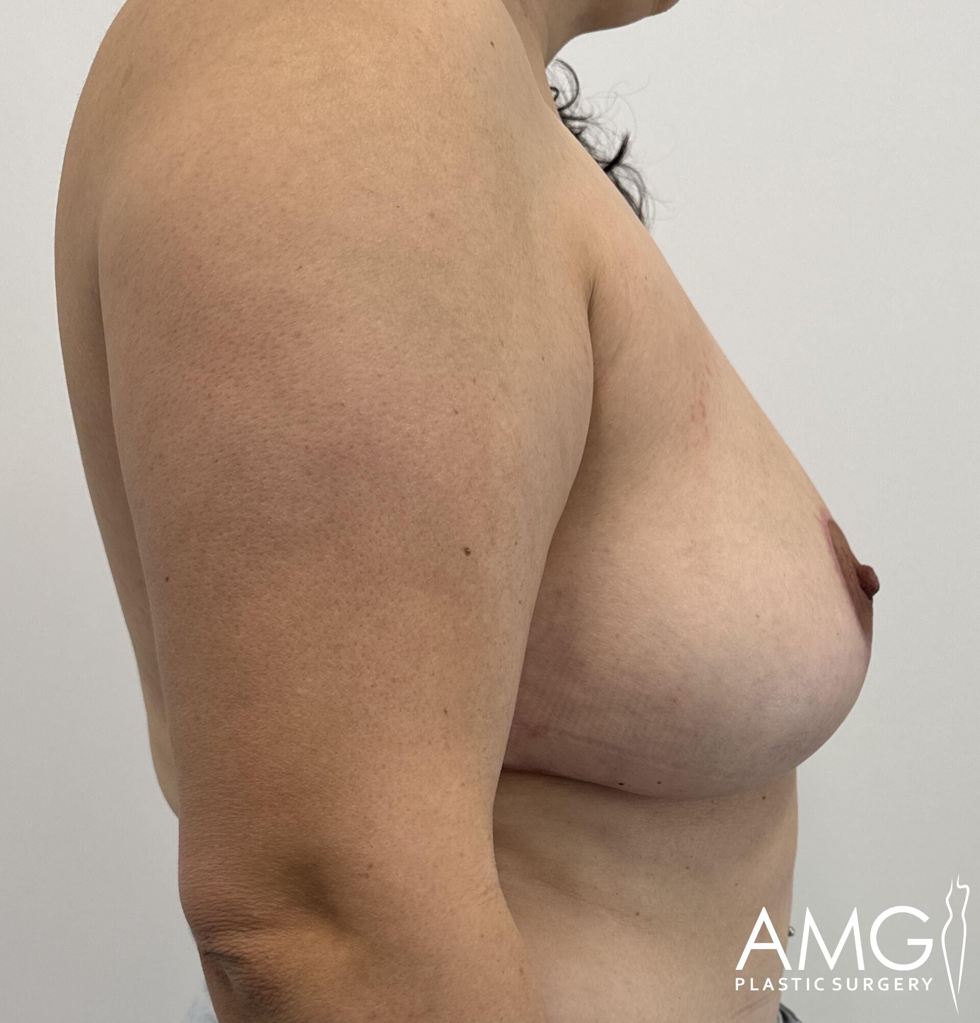Profile view of an adult's torso with bare upper body against a white background.
