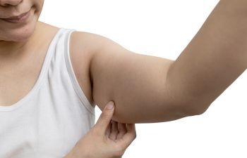 A woman wearing a white tank top pinching the excess skin on her upper arm.