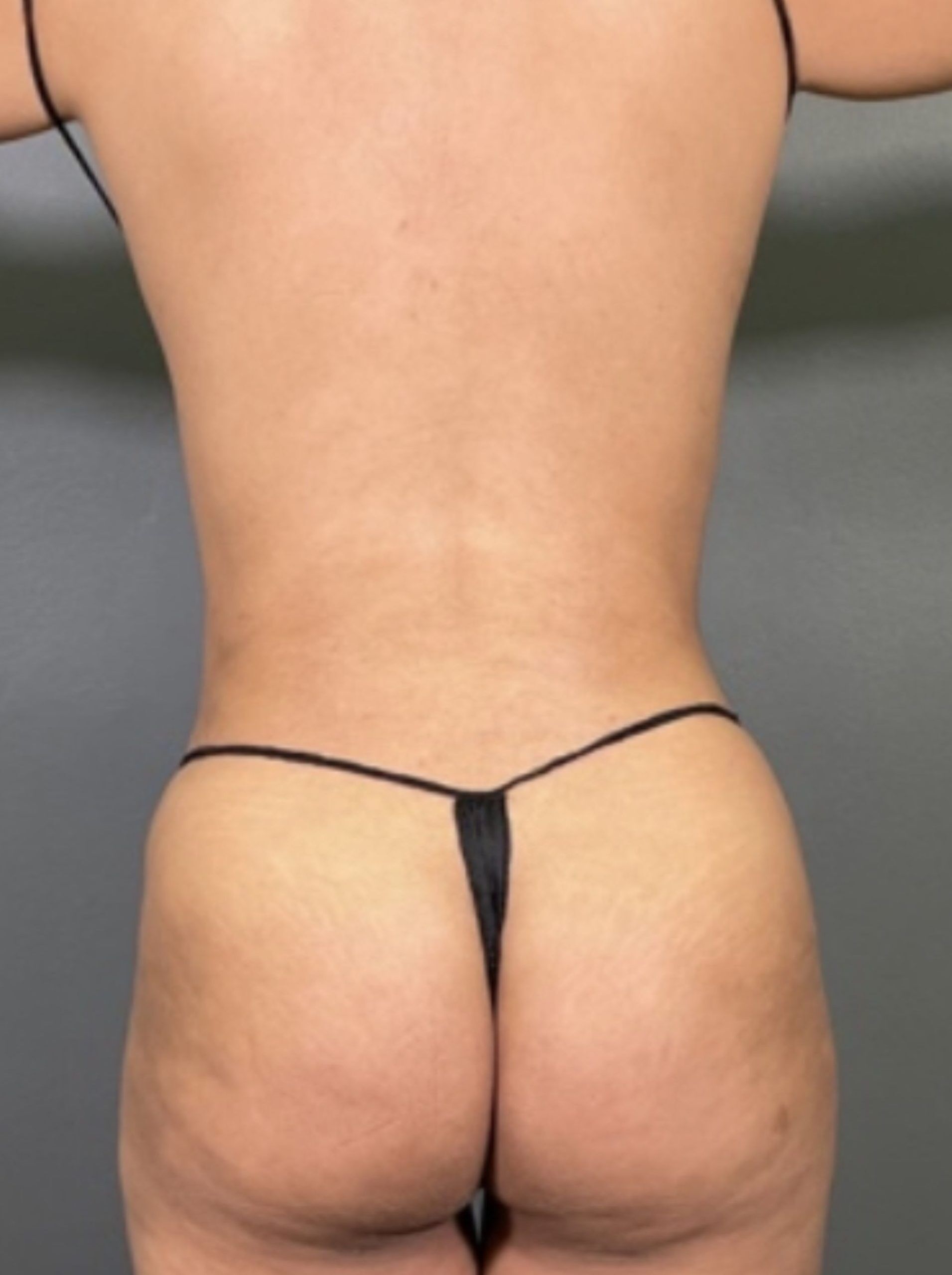 Person in a minimal black string bikini, showing their back and legs, standing against a gray background.
