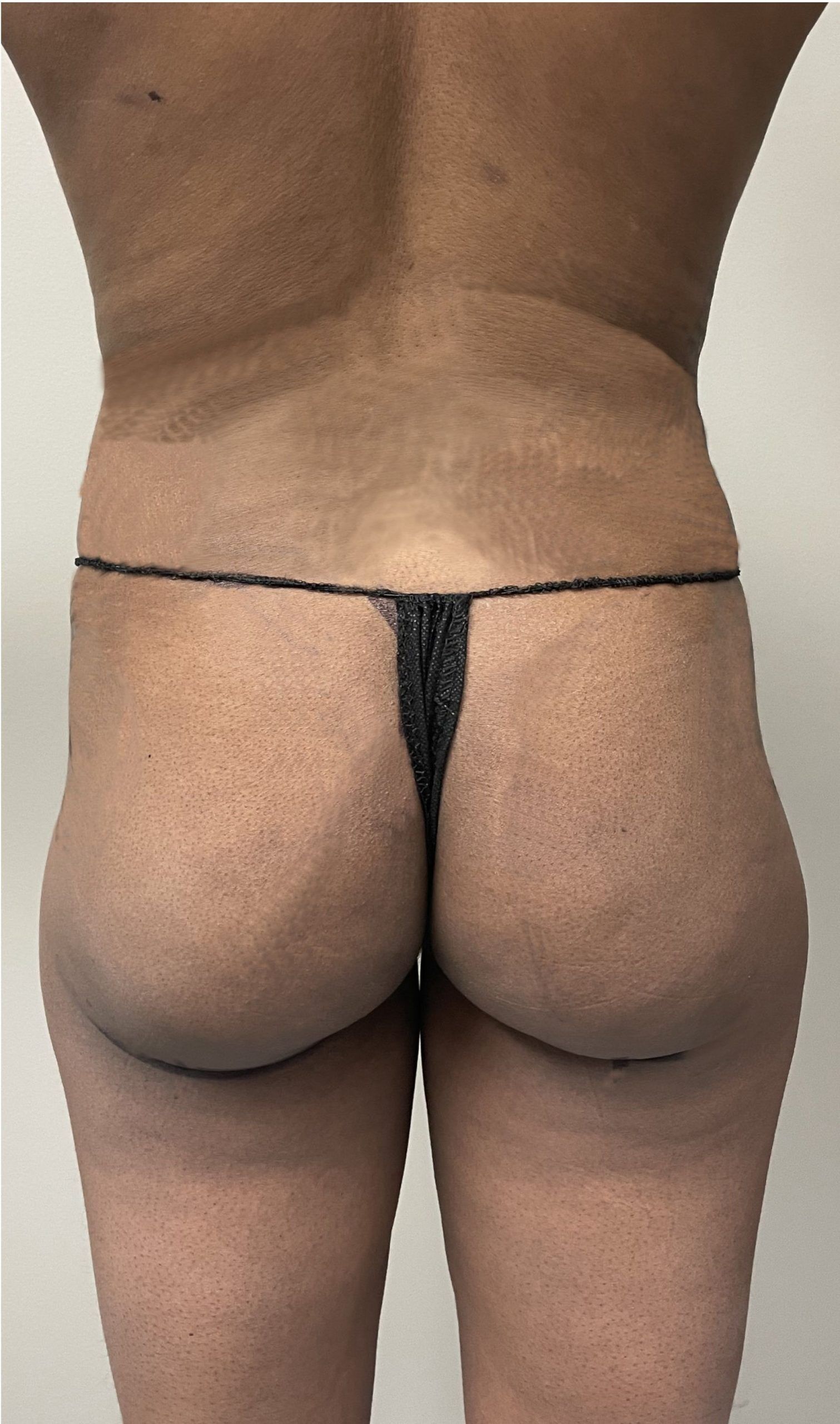 A person in black underwear is shown from the back, displaying natural skin texture. The logo 