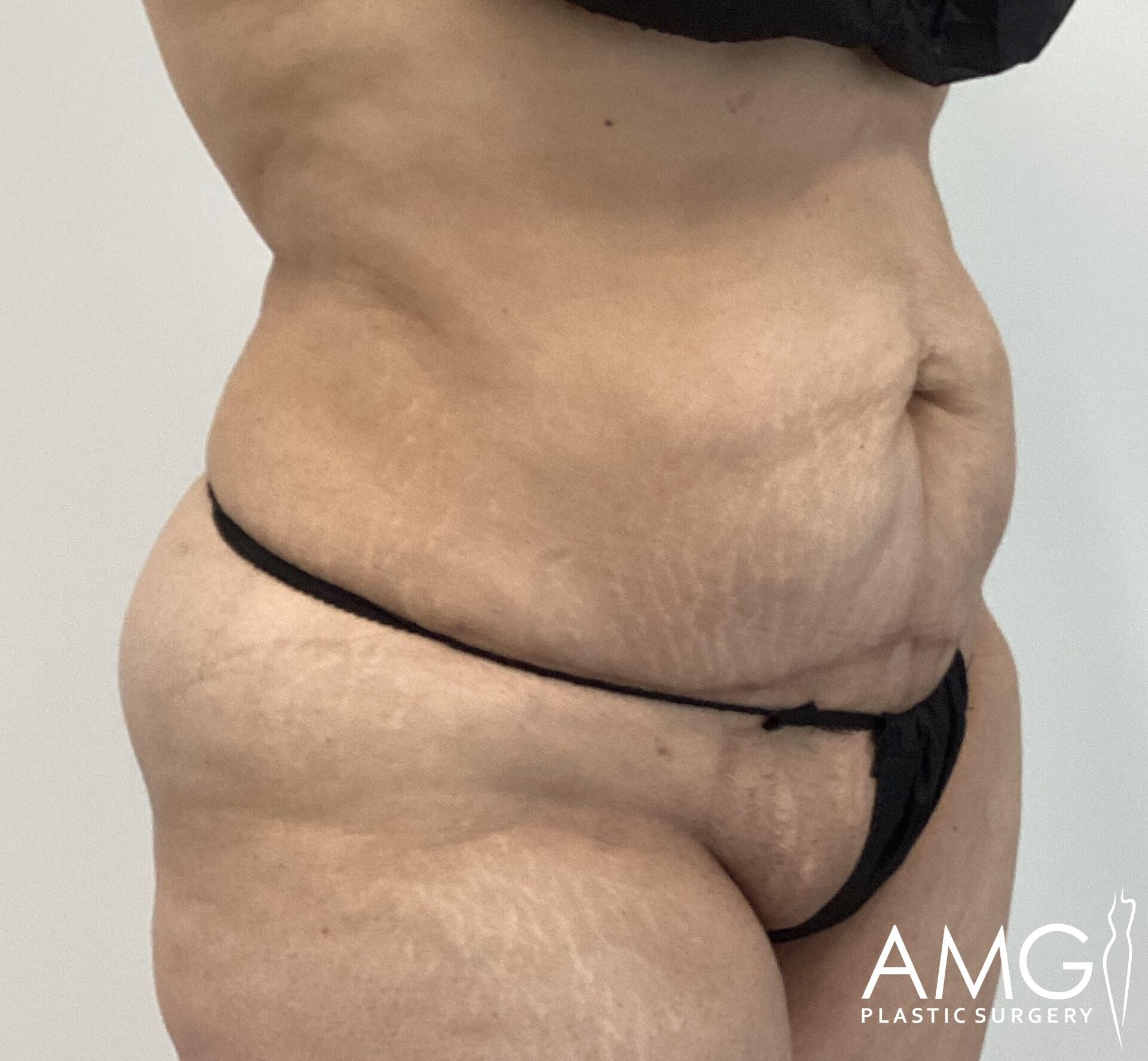 Person wearing black undergarments standing against a plain background, showing midsection and arms.