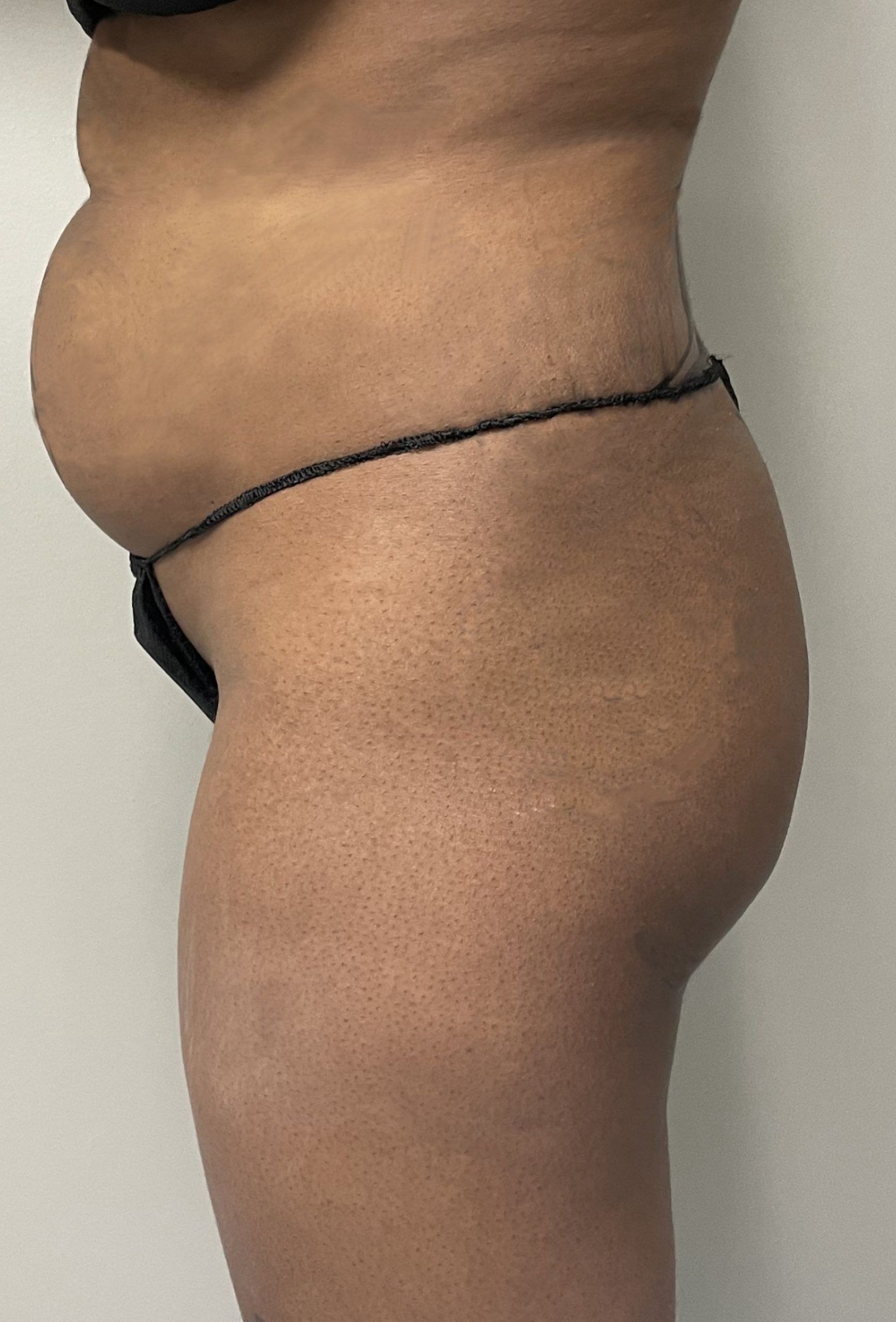 Side view of a person showing torso and hips in black underwear against a neutral background, with a logo in the bottom right corner.