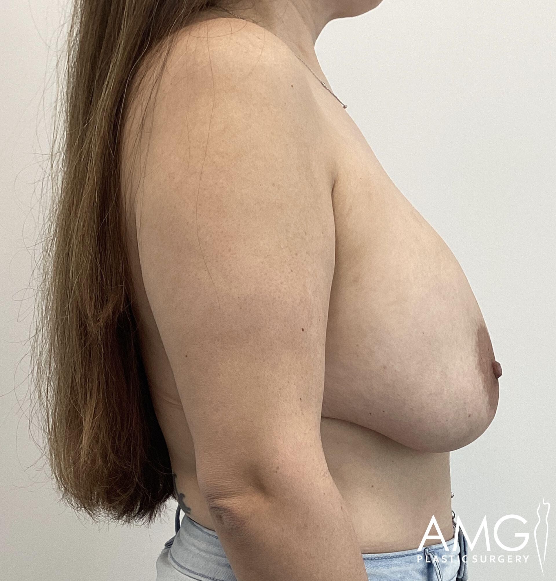 A person with long hair is shown from the side, displaying their chest without a top. The background is a plain, light color.