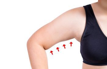 An arm of a woman in a black sleeveless top with four red arrows pointing arm lift plastic surgery area.